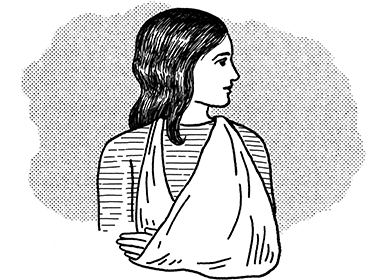 An illustration of a woman with her arm in a sling.
